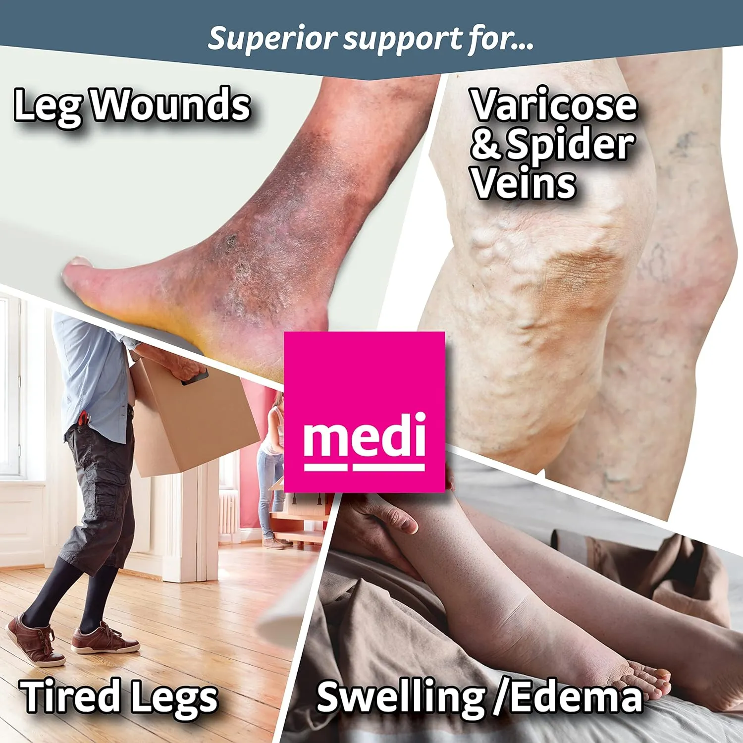 mediven Plus for Men & Women, 20-30 mmHg – Closed Toe, Thigh High Compression Stockings